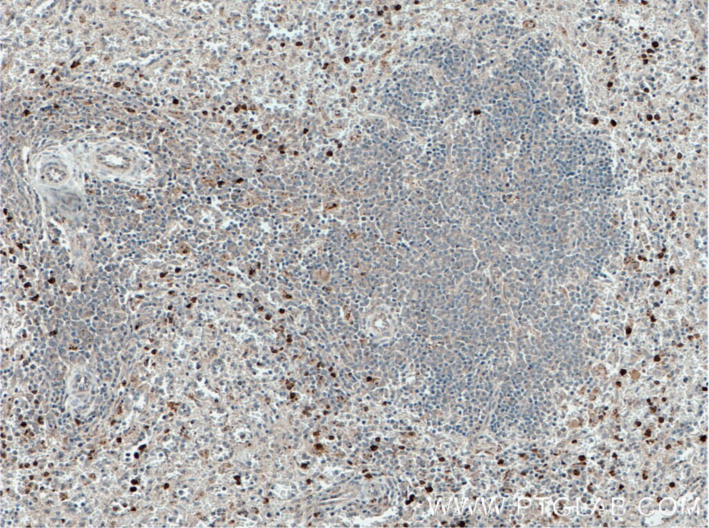 Immunohistochemistry (IHC) staining of human spleen tissue using NLRP7 Polyclonal antibody (27897-1-AP)