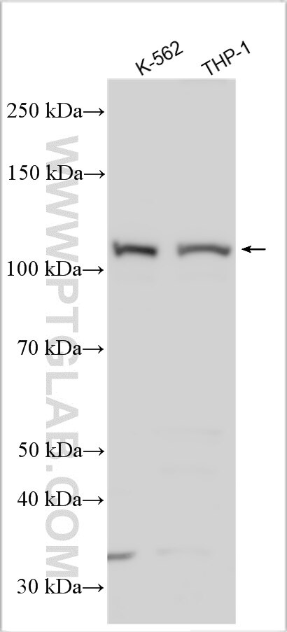 Western Blot (WB) analysis of various lysates using NLRP7 Polyclonal antibody (27897-1-AP)