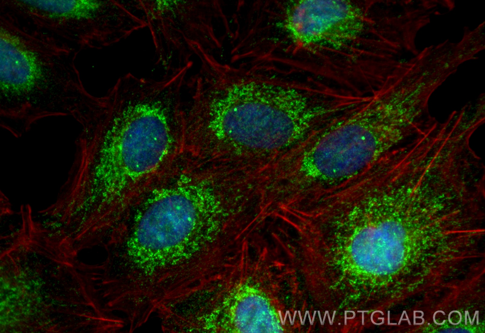 Immunofluorescence (IF) / fluorescent staining of A549 cells using NLRX1 Polyclonal antibody (17215-1-AP)