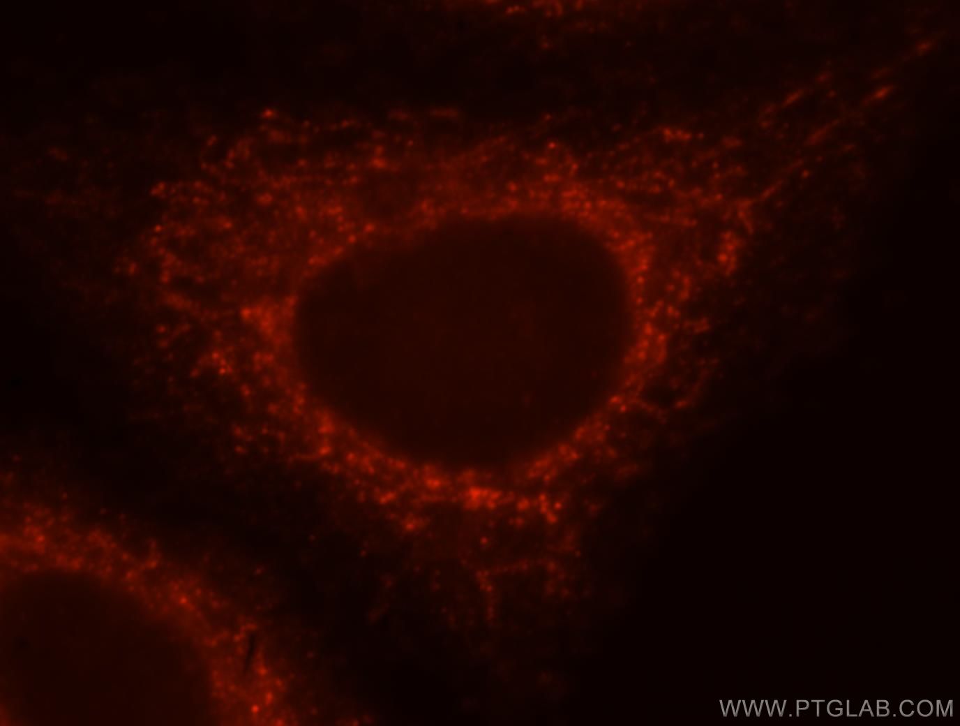 Immunofluorescence (IF) / fluorescent staining of HepG2 cells using NLRX1 Polyclonal antibody (17215-1-AP)