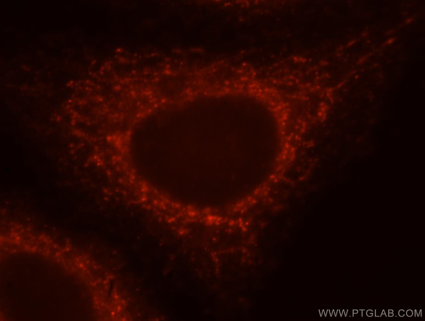 IF Staining of HepG2 using 17215-1-AP