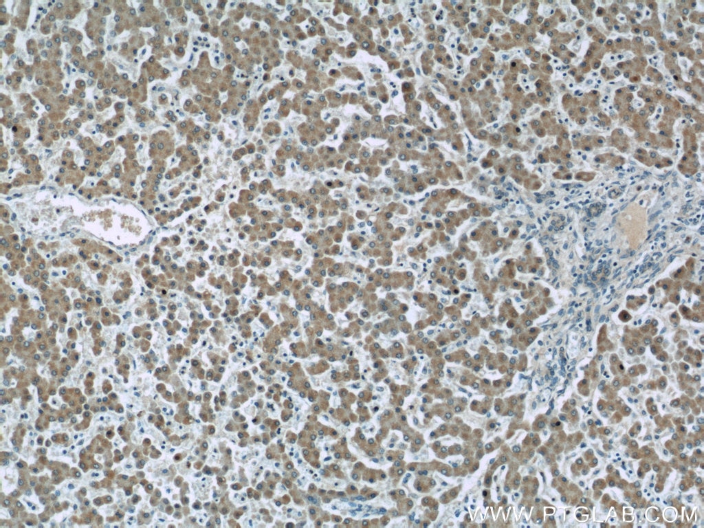 Immunohistochemistry (IHC) staining of human liver tissue using NLRX1 Polyclonal antibody (17215-1-AP)