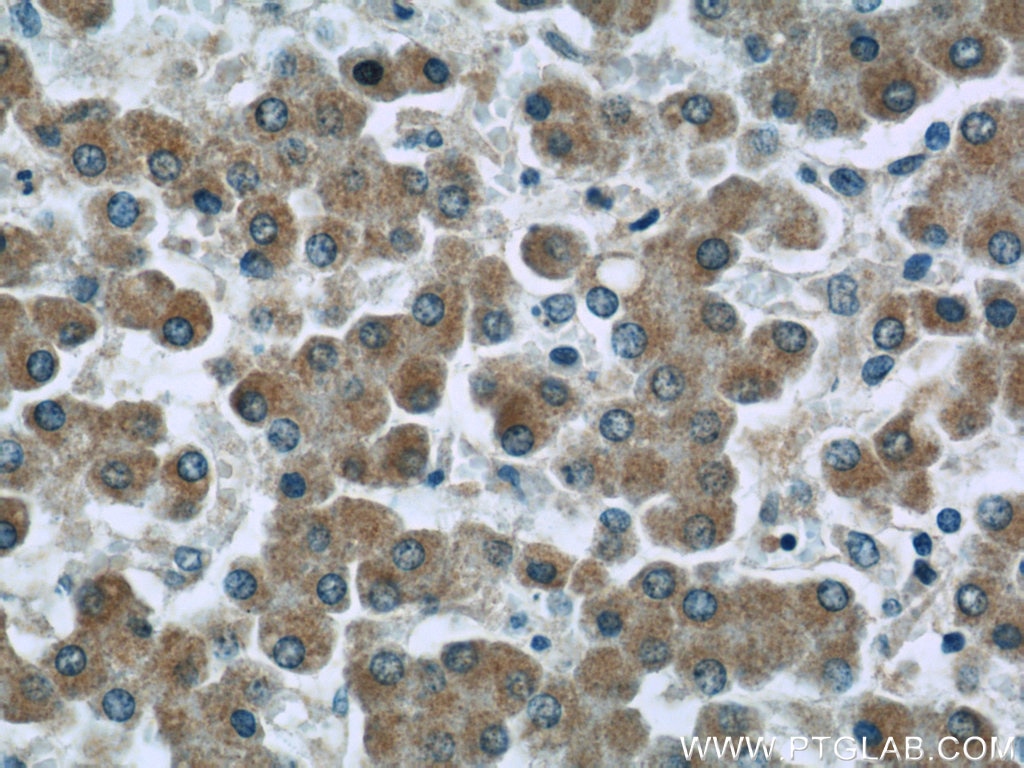 Immunohistochemistry (IHC) staining of human liver tissue using NLRX1 Polyclonal antibody (17215-1-AP)