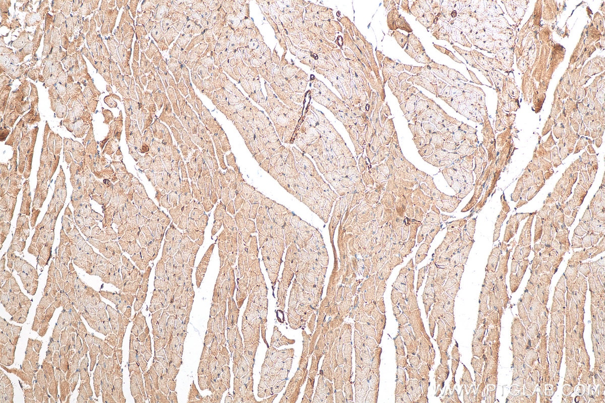 Immunohistochemistry (IHC) staining of mouse heart tissue using NLRX1 Polyclonal antibody (17215-1-AP)