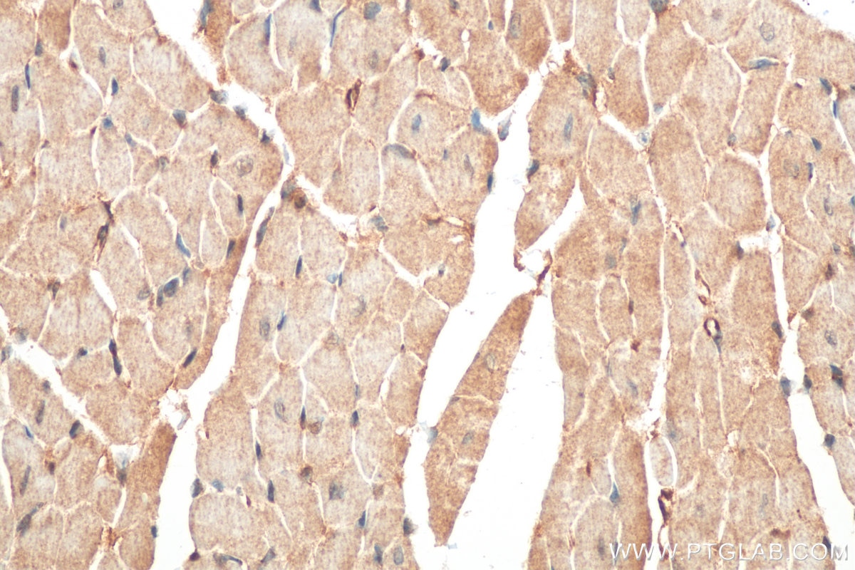 Immunohistochemistry (IHC) staining of mouse heart tissue using NLRX1 Polyclonal antibody (17215-1-AP)