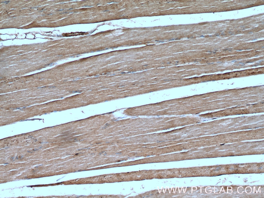 IHC staining of human skeletal muscle using 17215-1-AP