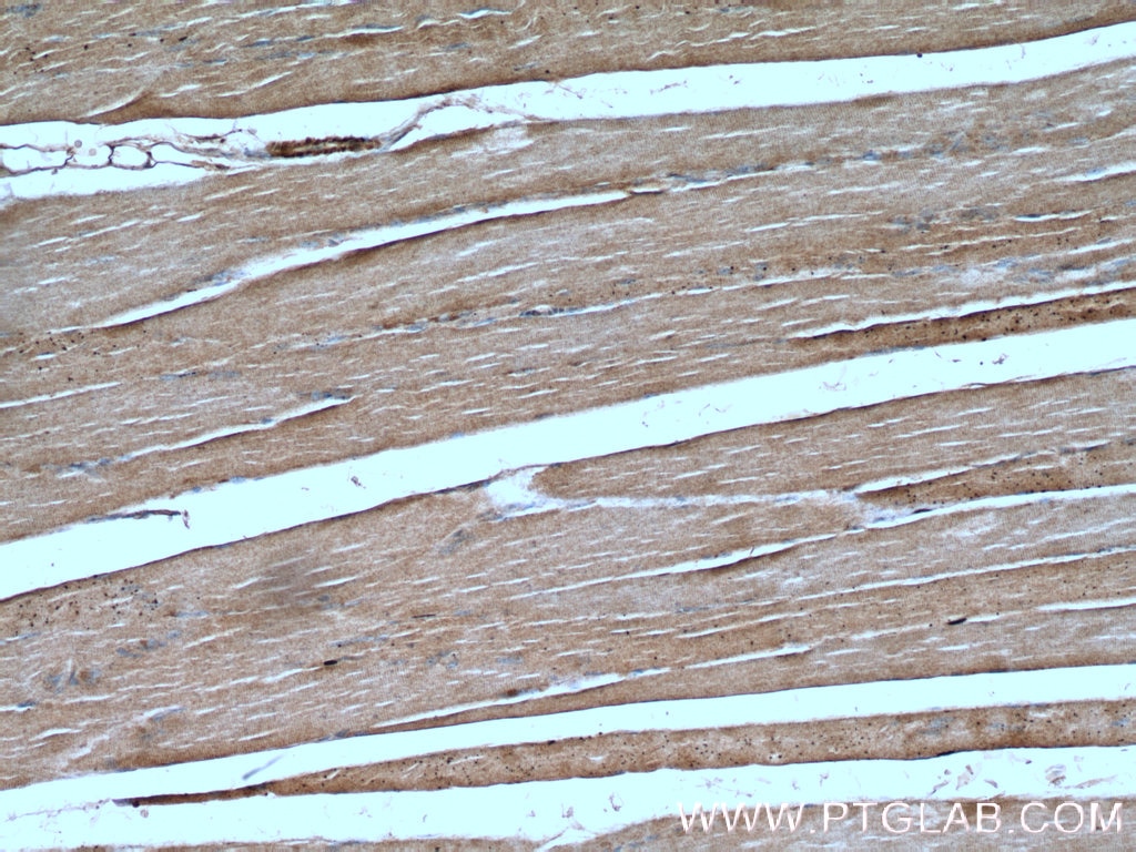 Immunohistochemistry (IHC) staining of human skeletal muscle tissue using NLRX1 Polyclonal antibody (17215-1-AP)