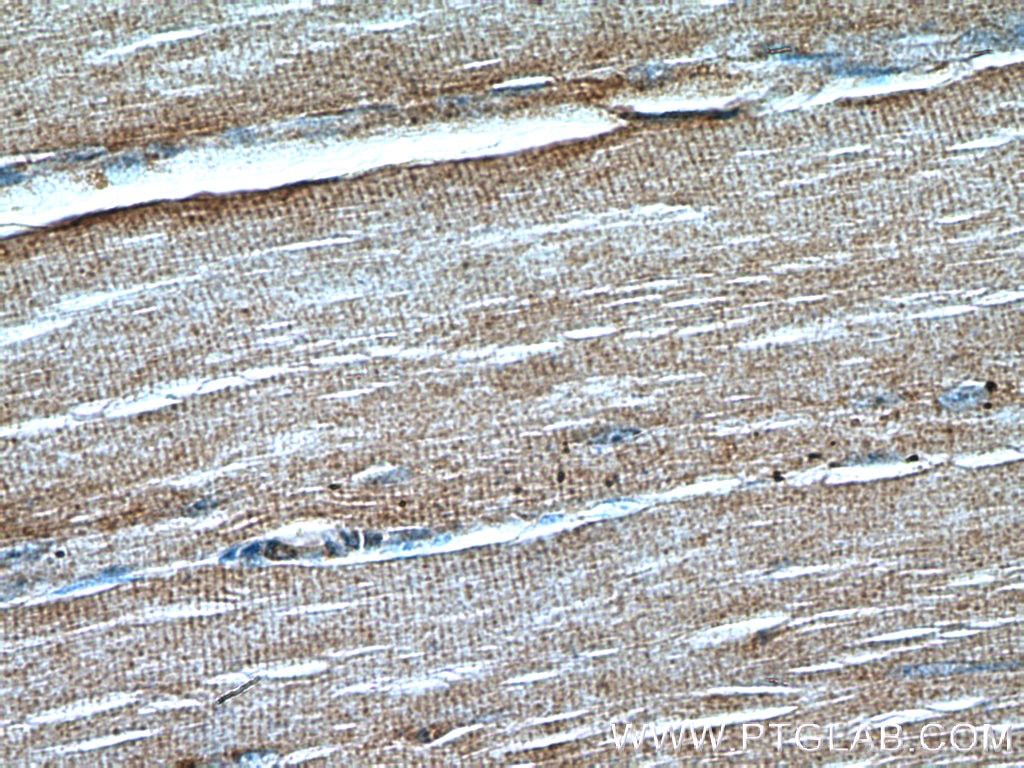 Immunohistochemistry (IHC) staining of human skeletal muscle tissue using NLRX1 Polyclonal antibody (17215-1-AP)