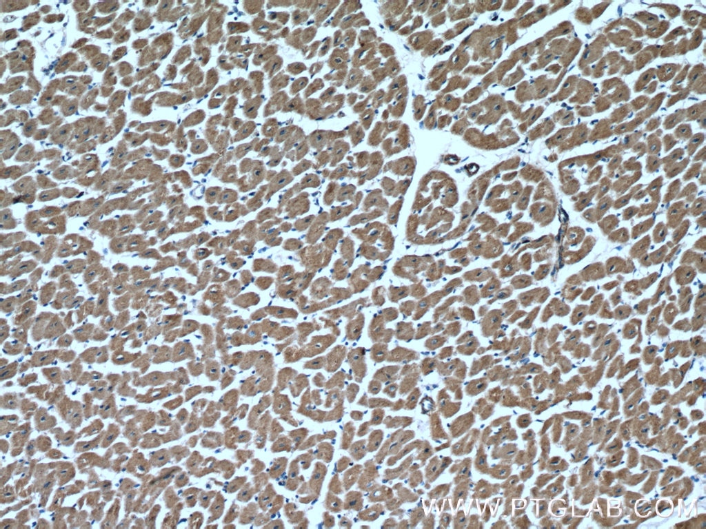 Immunohistochemistry (IHC) staining of human heart tissue using NLRX1 Polyclonal antibody (17215-1-AP)