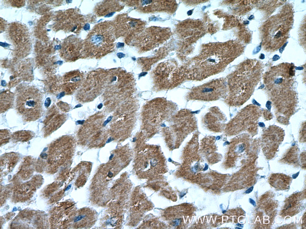 Immunohistochemistry (IHC) staining of human heart tissue using NLRX1 Polyclonal antibody (17215-1-AP)