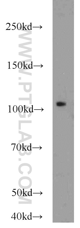 WB analysis of HepG2 using 17215-1-AP