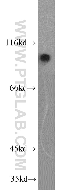 WB analysis of mouse skeletal muscle using 17215-1-AP