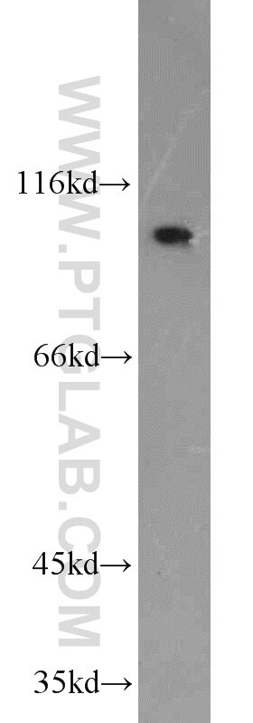 Western Blot (WB) analysis of MCF-7 cells using NLRX1 Polyclonal antibody (17215-1-AP)