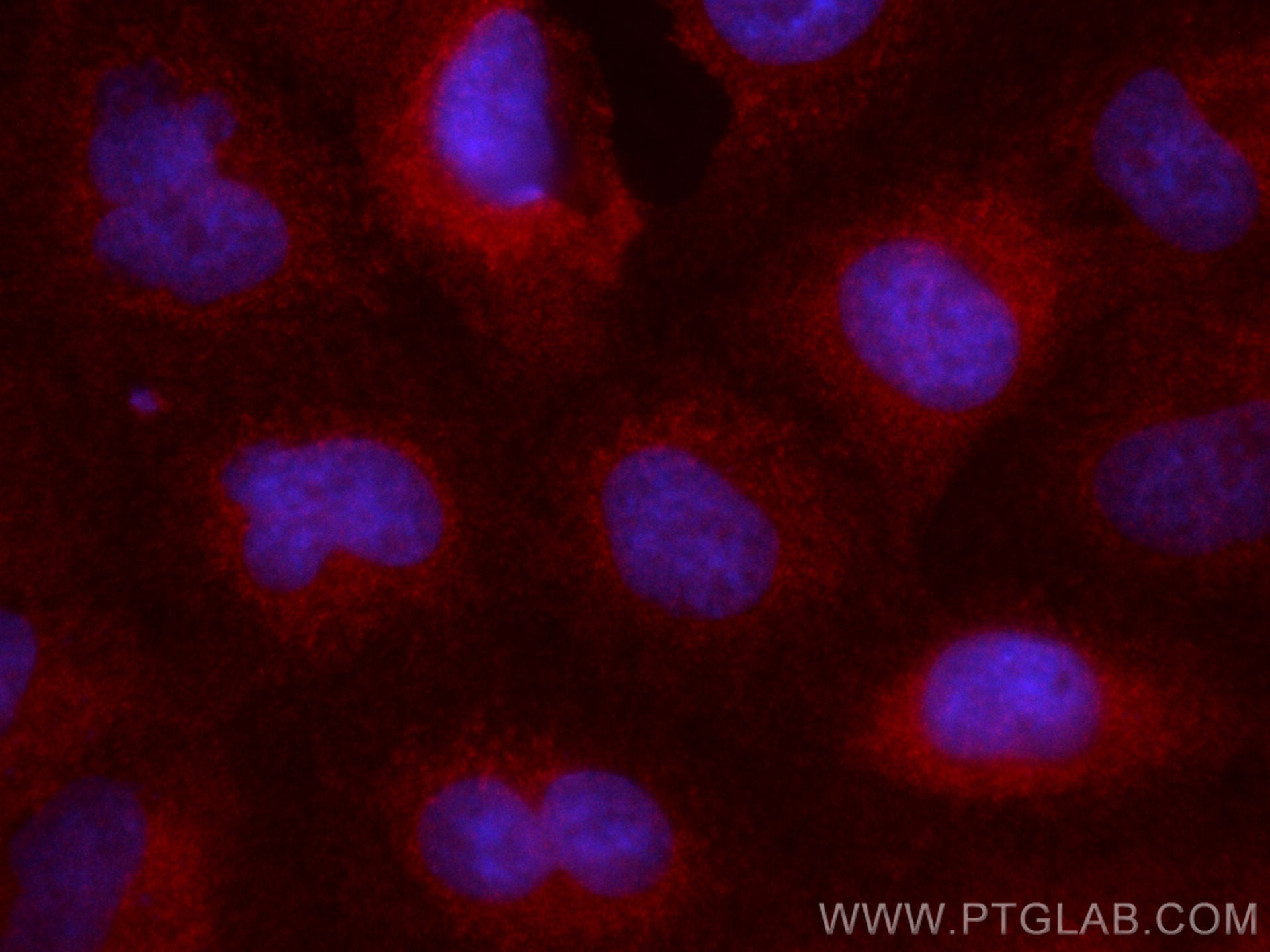 Immunofluorescence (IF) / fluorescent staining of A549 cells using CoraLite®594-conjugated NLRX1 Polyclonal antibody (CL594-17215)
