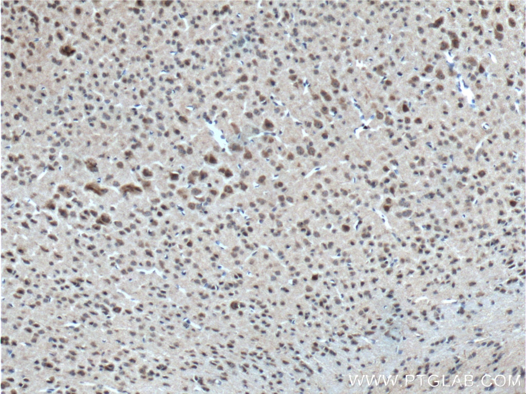 Immunohistochemistry (IHC) staining of mouse brain tissue using neuromedin B Polyclonal antibody (10888-1-AP)