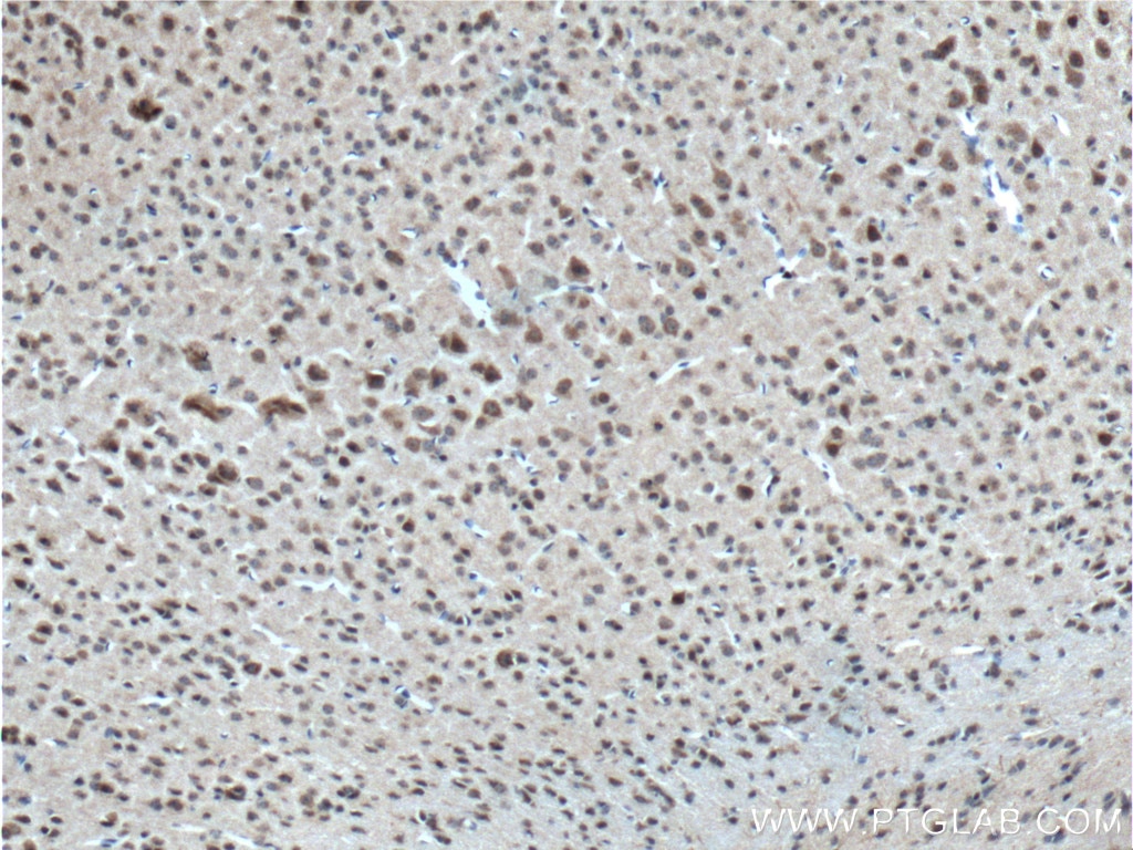 Immunohistochemistry (IHC) staining of mouse brain tissue using neuromedin B Polyclonal antibody (10888-1-AP)