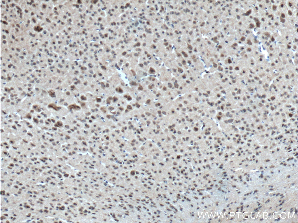 IHC staining of mouse brain using 10888-1-AP