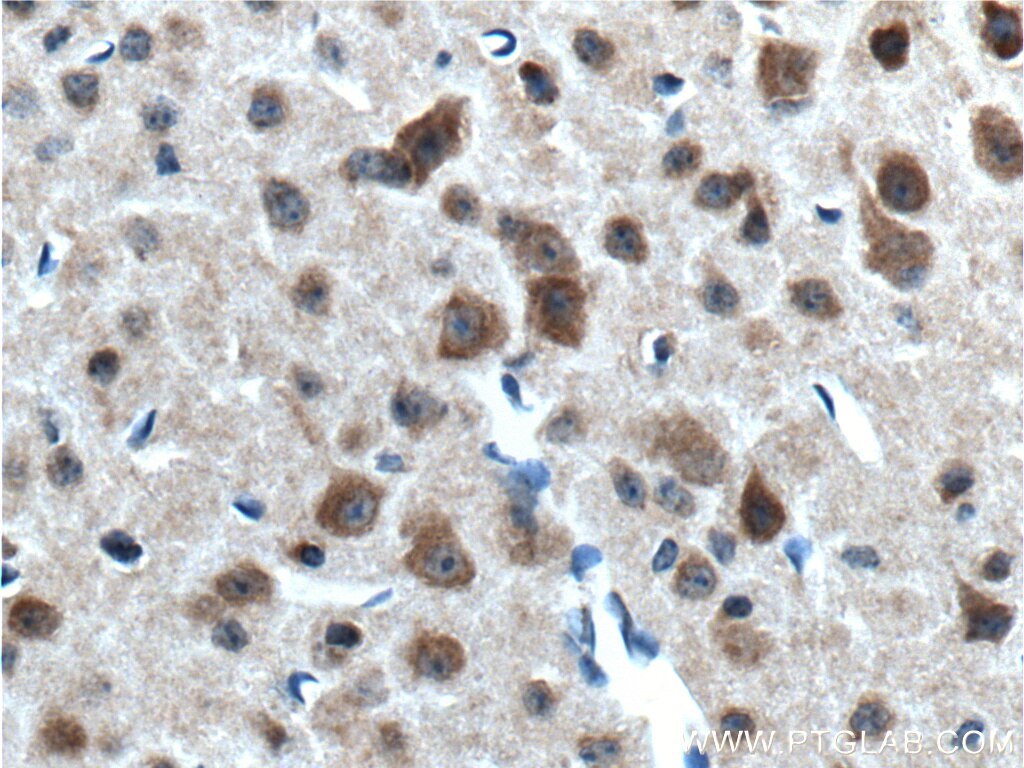 Immunohistochemistry (IHC) staining of mouse brain tissue using neuromedin B Polyclonal antibody (10888-1-AP)