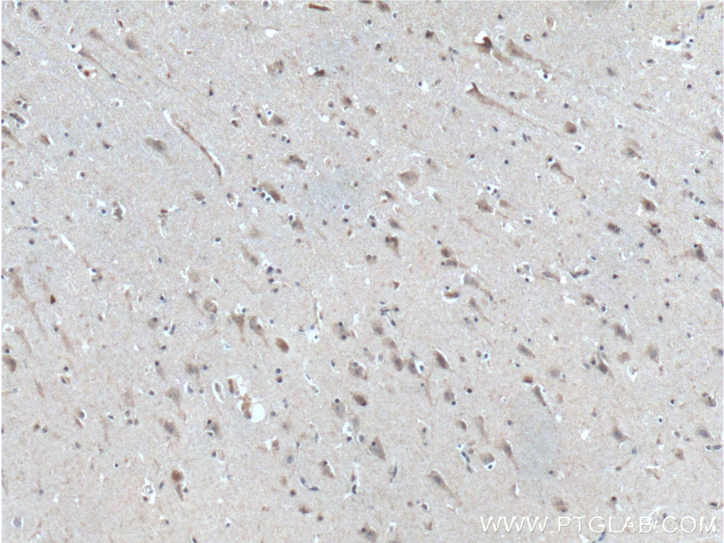 Immunohistochemistry (IHC) staining of human brain tissue using neuromedin B Polyclonal antibody (10888-1-AP)