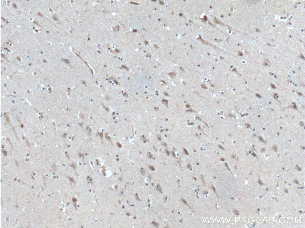 IHC staining of human brain using 10888-1-AP