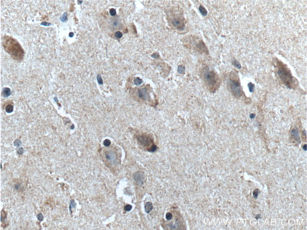 Immunohistochemistry (IHC) staining of human brain tissue using neuromedin B Polyclonal antibody (10888-1-AP)