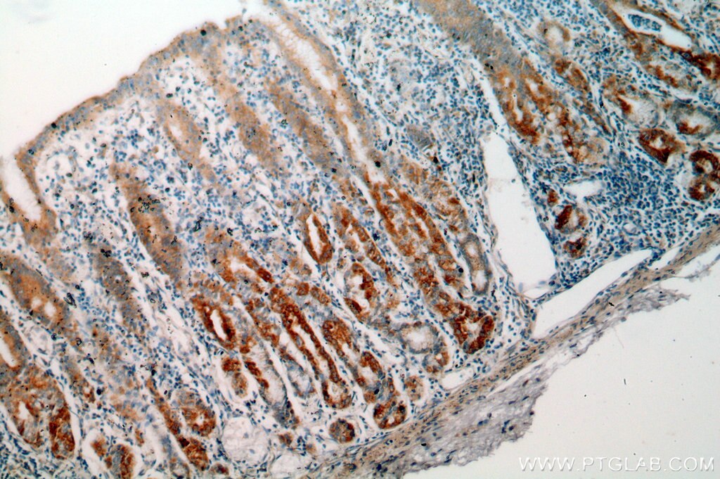 IHC staining of human stomach using 10888-1-AP