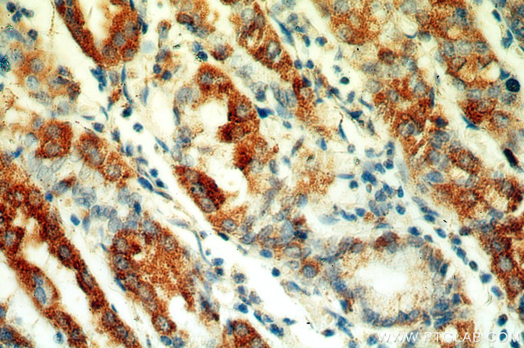 Immunohistochemistry (IHC) staining of human stomach tissue using neuromedin B Polyclonal antibody (10888-1-AP)