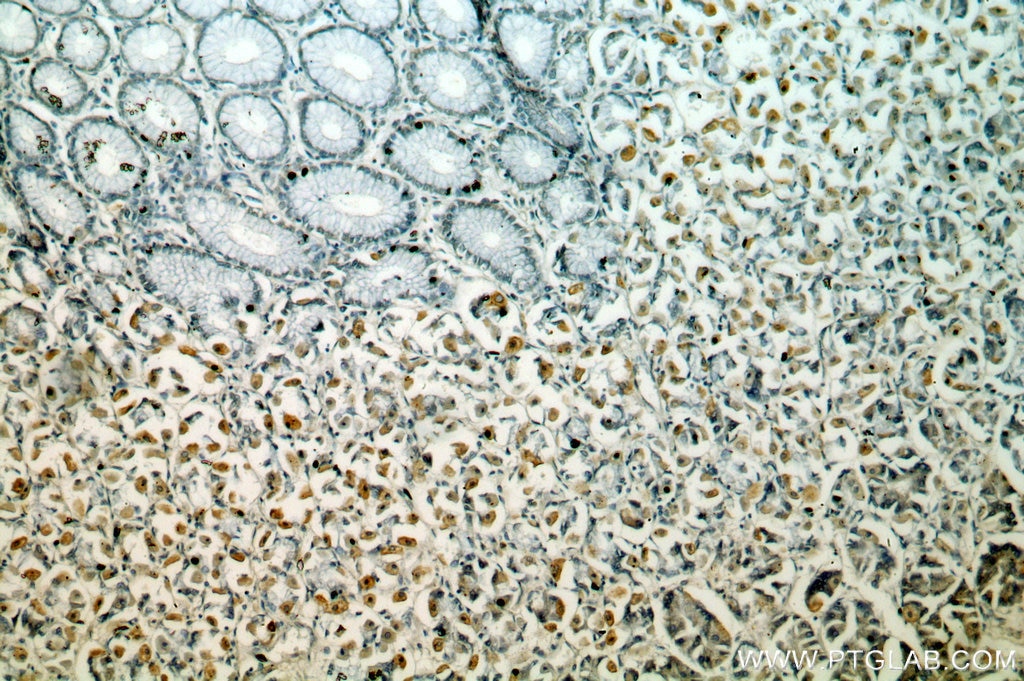 Immunohistochemistry (IHC) staining of human stomach tissue using neuromedin B Polyclonal antibody (10888-1-AP)