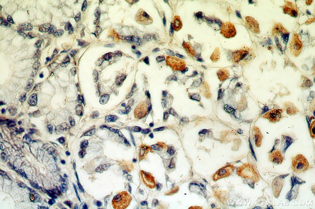 Immunohistochemistry (IHC) staining of human stomach tissue using neuromedin B Polyclonal antibody (10888-1-AP)