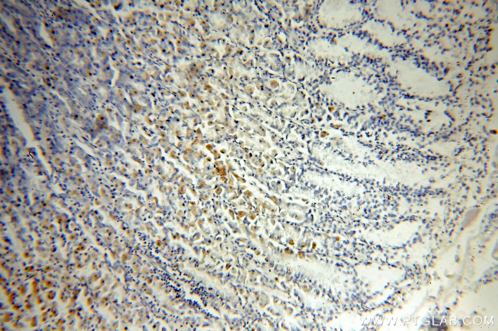 Immunohistochemistry (IHC) staining of human stomach tissue using neuromedin B Polyclonal antibody (10888-1-AP)