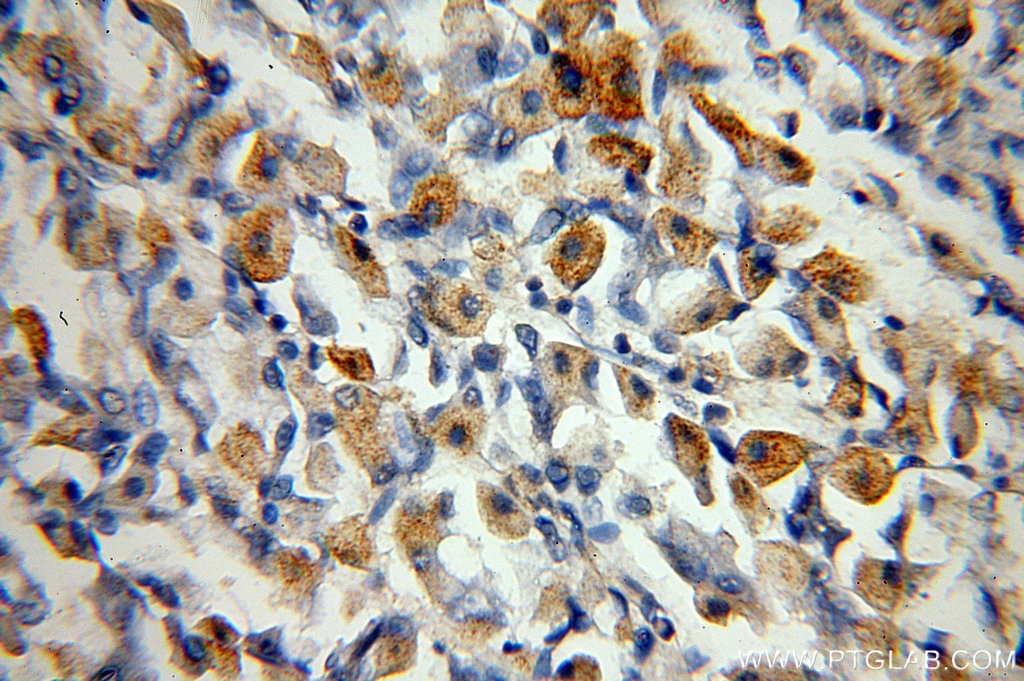 Immunohistochemistry (IHC) staining of human stomach tissue using neuromedin B Polyclonal antibody (10888-1-AP)