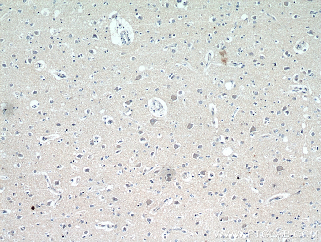 Immunohistochemistry (IHC) staining of human brain tissue using neuromedin B Polyclonal antibody (10888-1-AP)