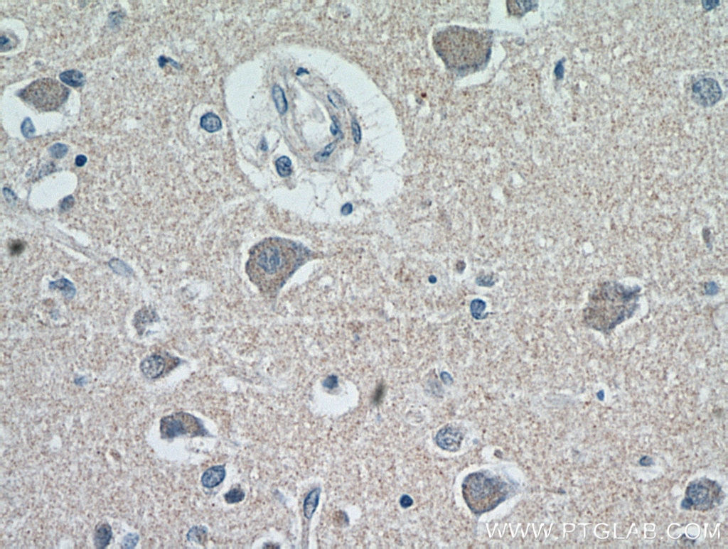 Immunohistochemistry (IHC) staining of human brain tissue using neuromedin B Polyclonal antibody (10888-1-AP)