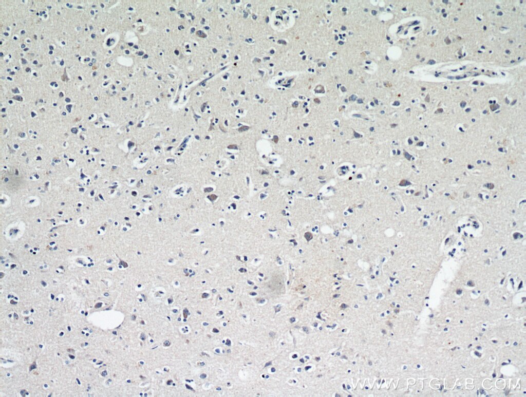 IHC staining of human brain using 10888-1-AP