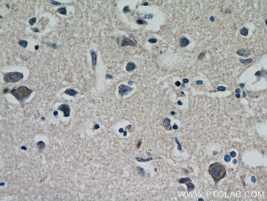 IHC staining of human brain using 10888-1-AP