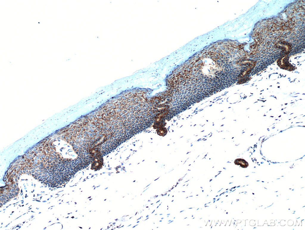 Immunohistochemistry (IHC) staining of human skin tissue using neuromedin B Polyclonal antibody (10888-1-AP)