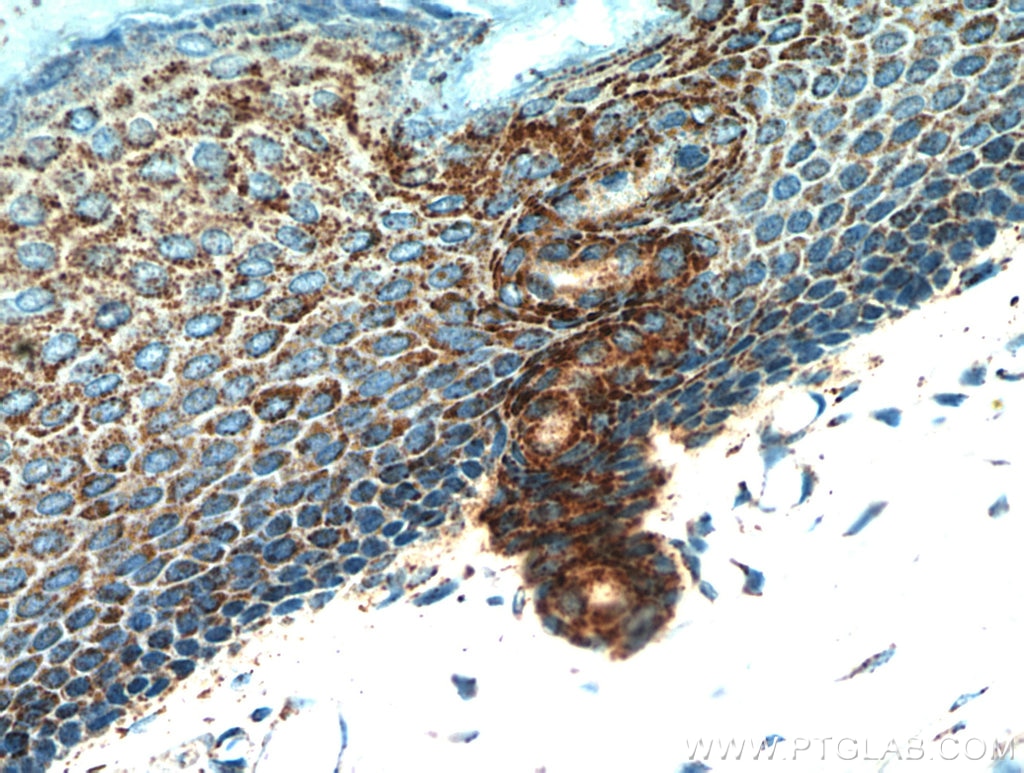 IHC staining of human skin using 10888-1-AP