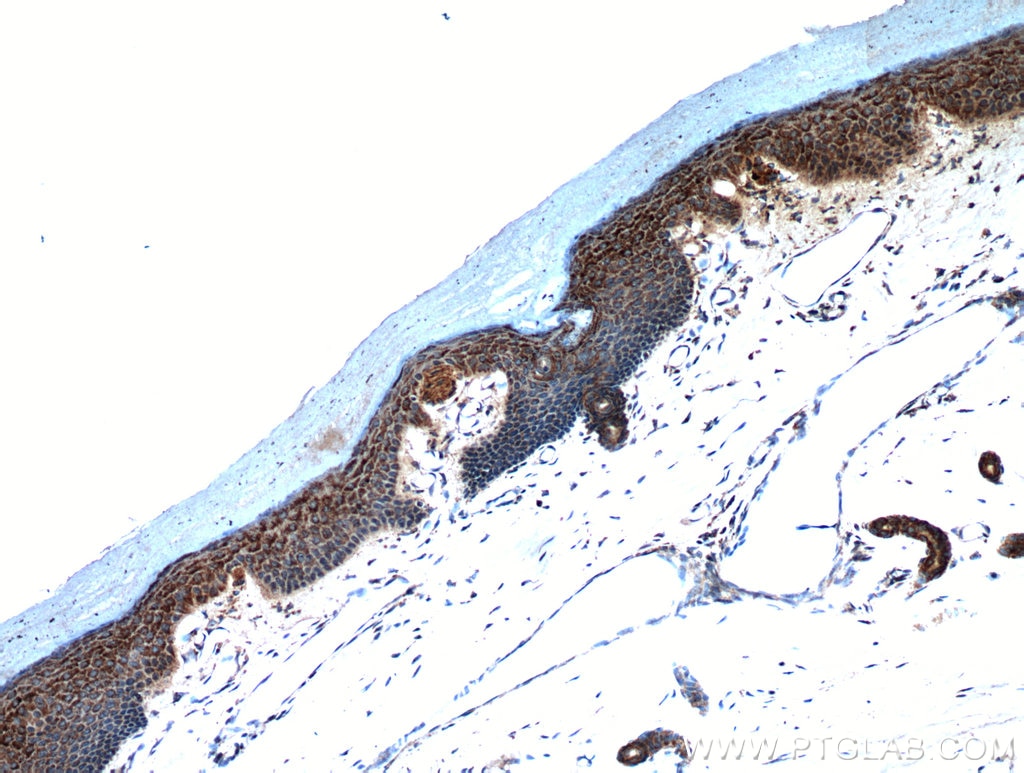 Immunohistochemistry (IHC) staining of human skin tissue using neuromedin B Polyclonal antibody (10888-1-AP)