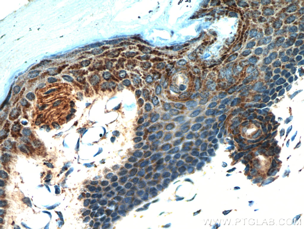 IHC staining of human skin using 10888-1-AP