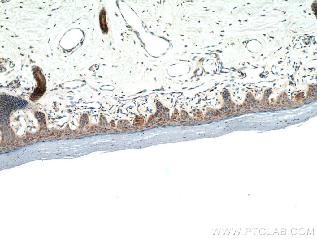 Immunohistochemistry (IHC) staining of human skin tissue using neuromedin B Polyclonal antibody (10888-1-AP)