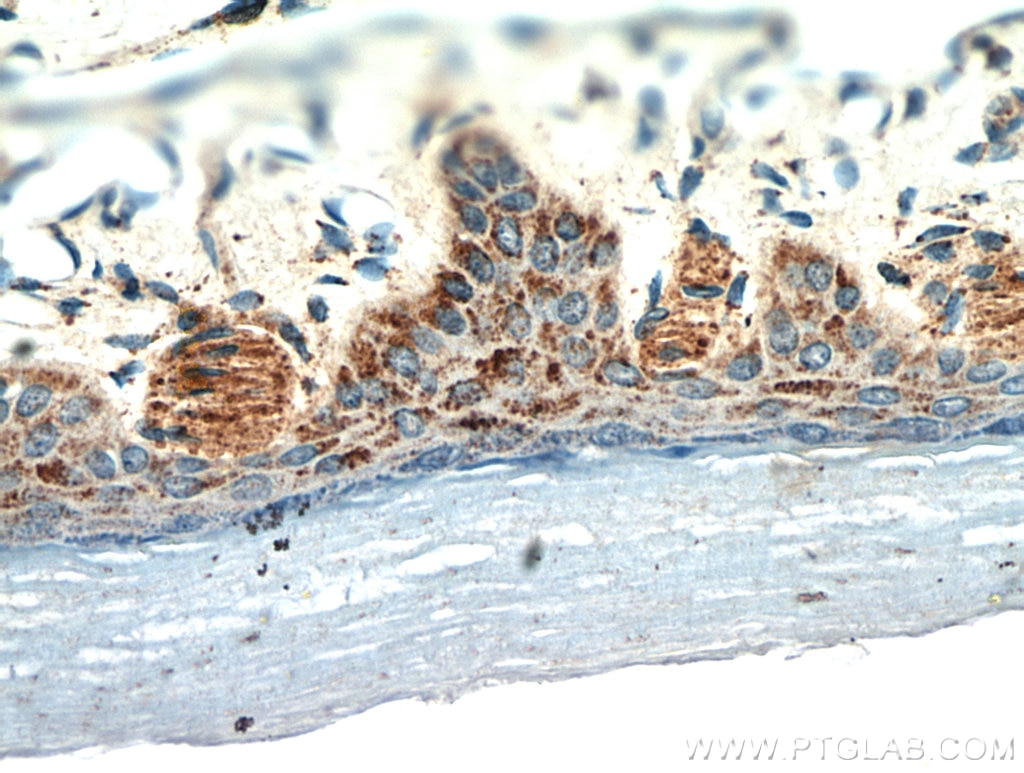 Immunohistochemistry (IHC) staining of human skin tissue using neuromedin B Polyclonal antibody (10888-1-AP)