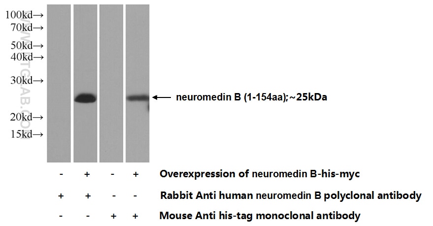 Western Blot (WB) analysis of Transfected HEK-293 cells using neuromedin B Polyclonal antibody (10888-1-AP)