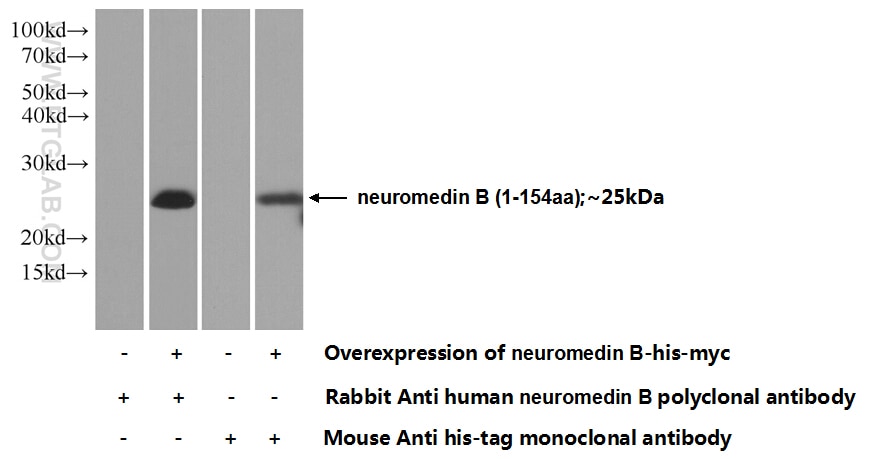 WB analysis of Transfected HEK-293 using 10888-1-AP