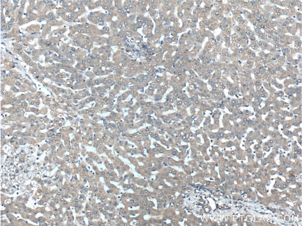 Immunohistochemistry (IHC) staining of human liver tissue using NMD3 Polyclonal antibody (16060-1-AP)