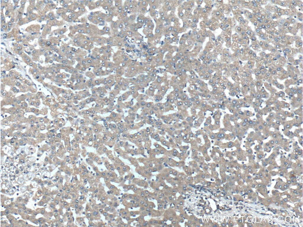 Immunohistochemistry (IHC) staining of human liver tissue using NMD3 Polyclonal antibody (16060-1-AP)