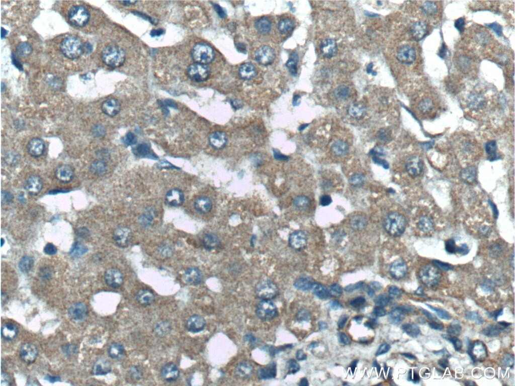 Immunohistochemistry (IHC) staining of human liver tissue using NMD3 Polyclonal antibody (16060-1-AP)