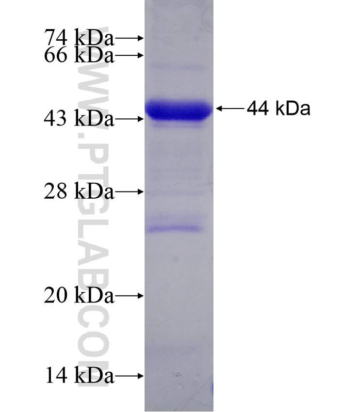 NMD3 fusion protein Ag9191 SDS-PAGE