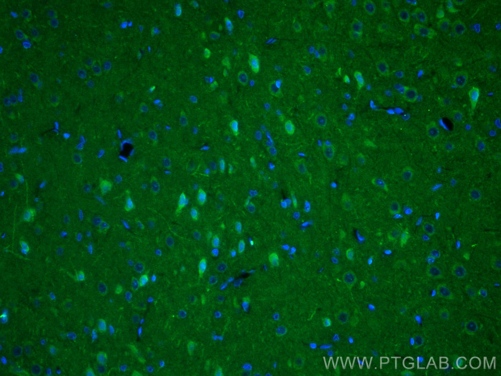 Immunofluorescence (IF) / fluorescent staining of rat brain tissue using NMDAR1 Polyclonal antibody (27232-1-AP)