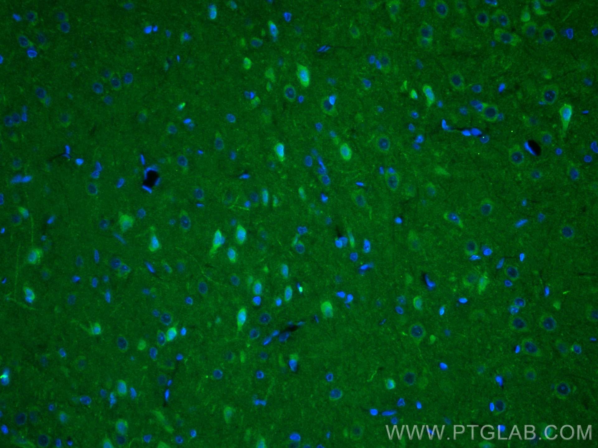 IF Staining of rat brain using 27232-1-AP