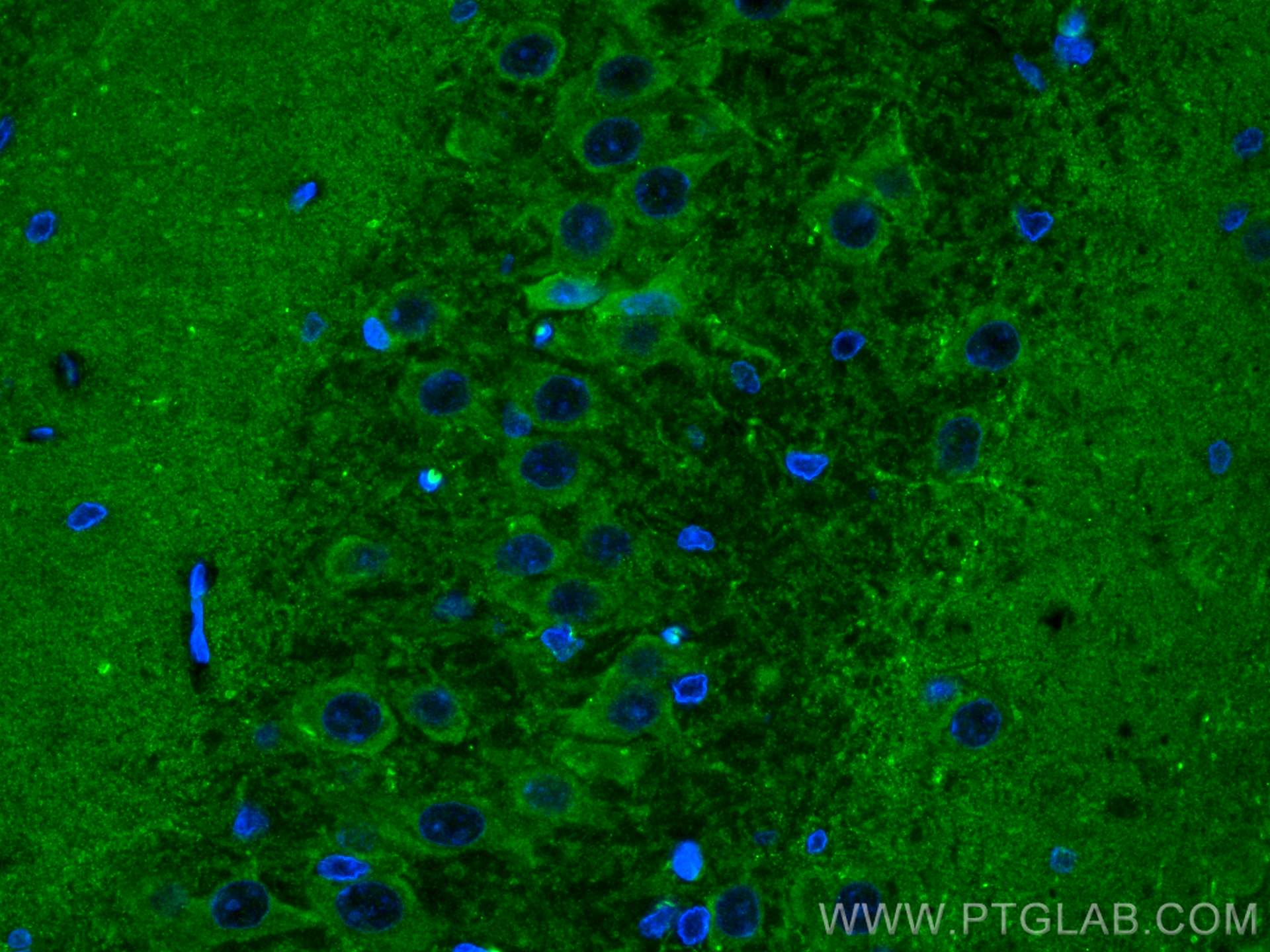 Immunofluorescence (IF) / fluorescent staining of rat brain tissue using NMDAR1 Polyclonal antibody (27232-1-AP)